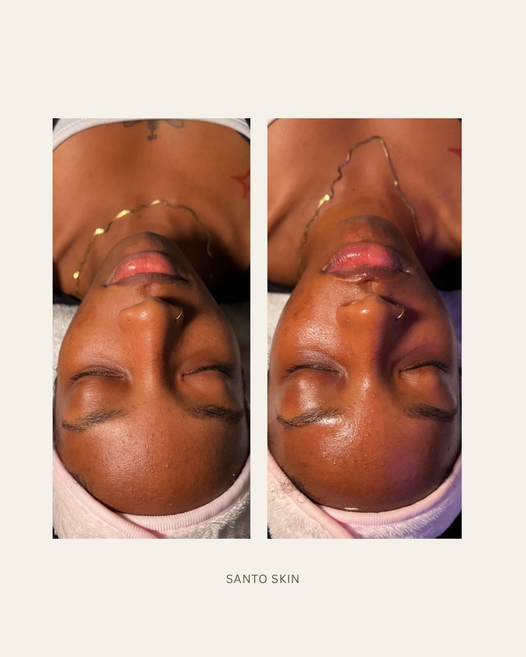 Client before and after a facial, showing brighter, hydrated skin
